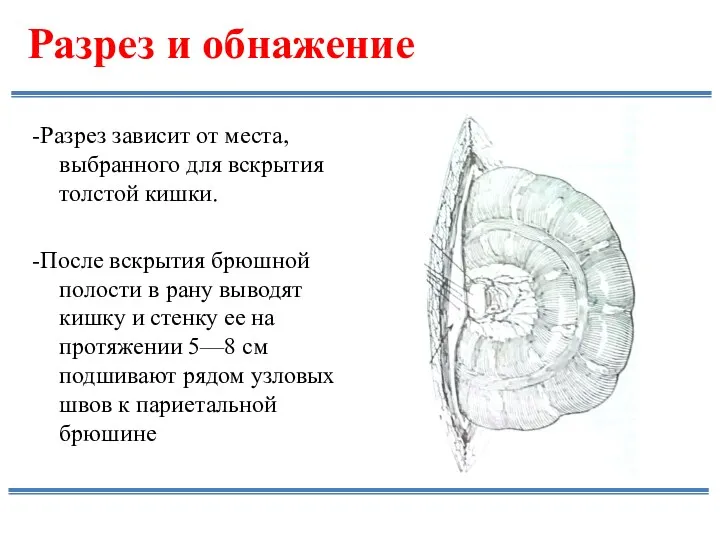 Разрез и обнажение -Разрез зависит от места, выбранного для вскрытия