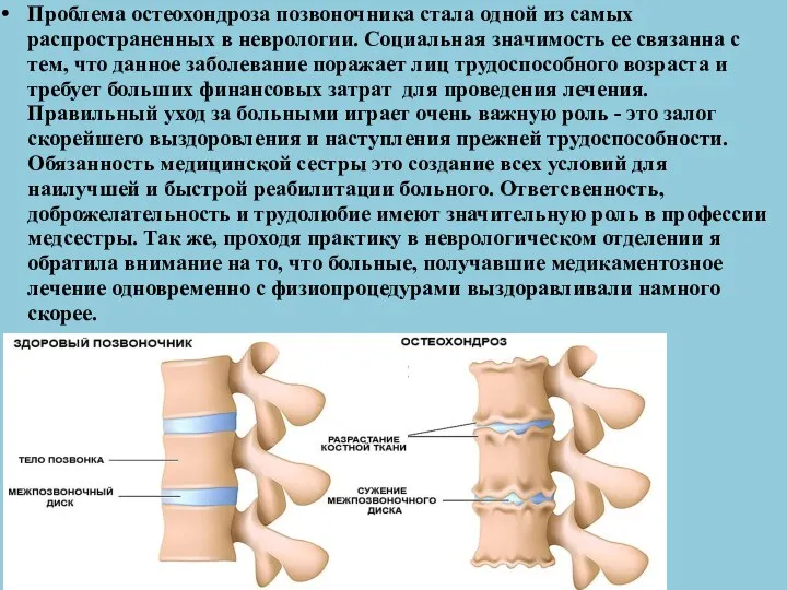 Проблема остеохондроза позвоночника стала одной из самых распространенных в неврологии.