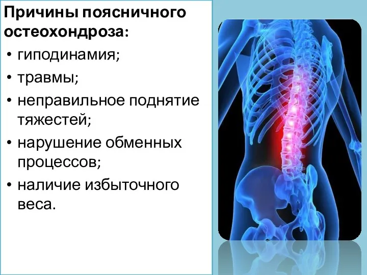 Причины поясничного остеохондроза: гиподинамия; травмы; неправильное поднятие тяжестей; нарушение обменных процессов; наличие избыточного веса.