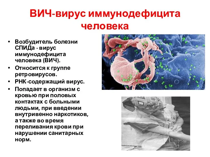 ВИЧ-вирус иммунодефицита человека Возбудитель болезни СПИДа - вирус иммунодефицита человека