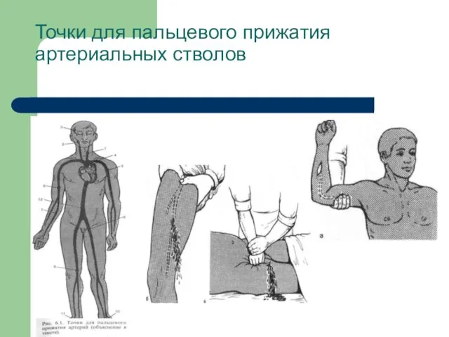 Точки для пальцевого прижатия артериальных стволов