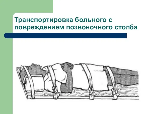 Транспортировка больного с повреждением позвоночного столба