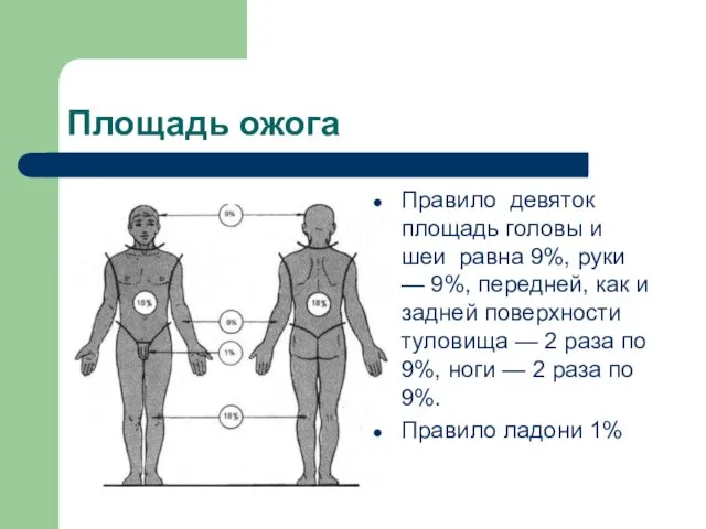 Площадь ожога Правило девяток площадь головы и шеи равна 9%,