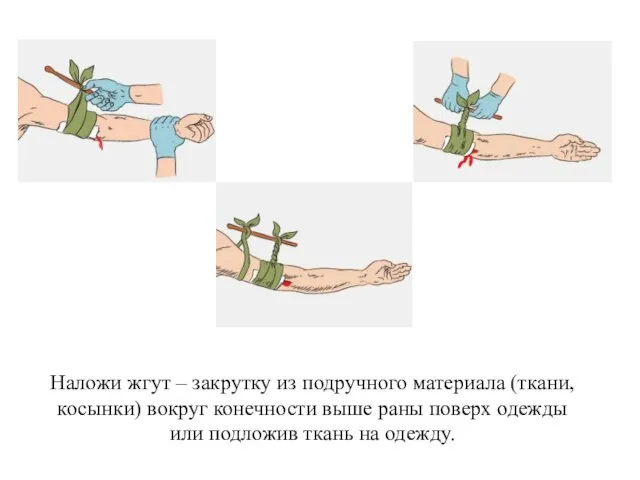 Наложи жгут – закрутку из подручного материала (ткани, косынки) вокруг