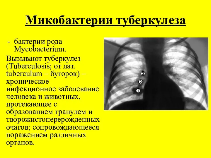 Микобактерии туберкулеза бактерии рода Mycobacterium. Вызывают туберкулез (Tuberculosis; от лат.