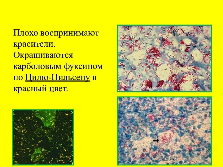 Плохо воспринимают красители. Окрашиваются карболовым фуксином по Цилю-Нильсену в красный цвет.