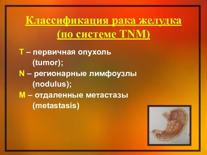 Классификация рака желудка (по системе TNM) T – первичная опухоль