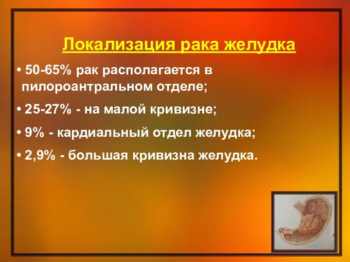 Локализация рака желудка 50-65% рак располагается в пилороантральном отделе; 25-27%