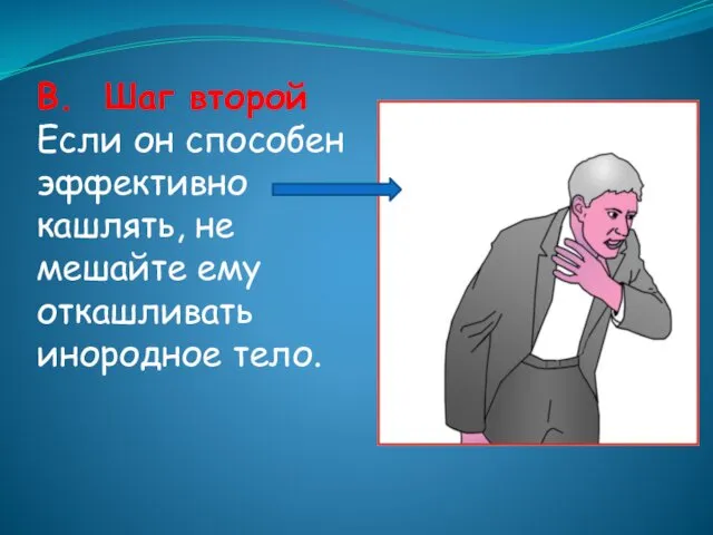 B. Шаг второй Если он способен эффективно кашлять, не мешайте ему откашливать инородное тело.