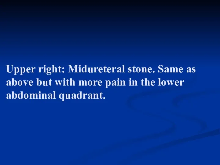 Upper right: Midureteral stone. Same as above but with more pain in the lower abdominal quadrant.