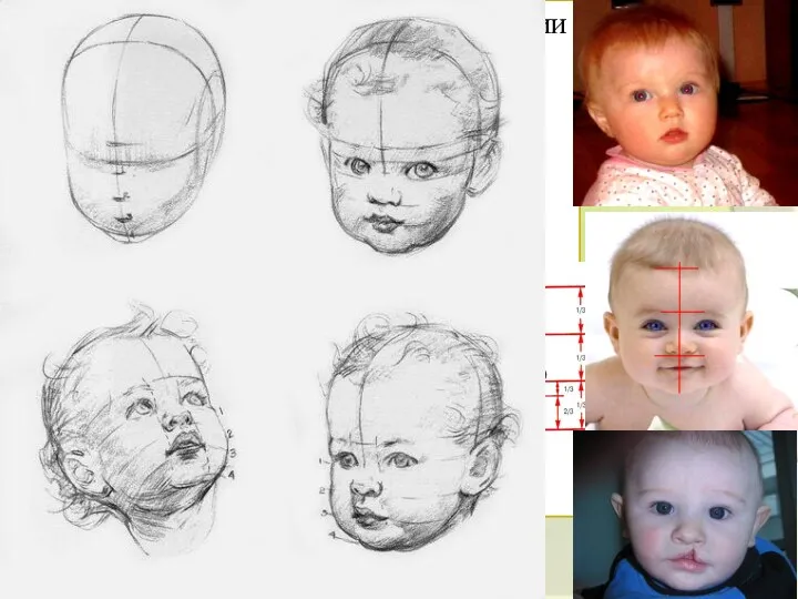 Вертикальные пропорции (баланс трех отделов лица в вертикальной плоскости – верхний, средний и нижний).