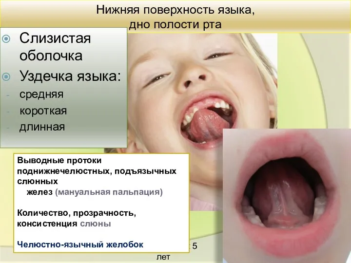 Нижняя поверхность языка, дно полости рта Слизистая оболочка Уздечка языка: средняя короткая длинная