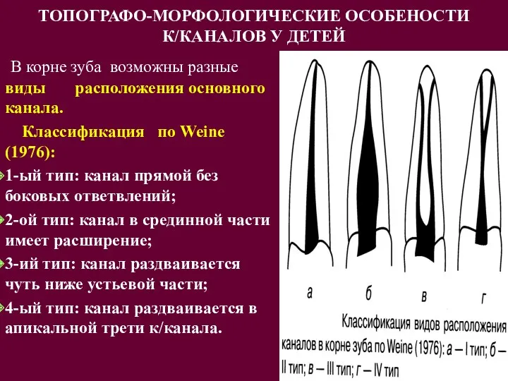 ТОПОГРАФО-МОРФОЛОГИЧЕСКИЕ ОСОБЕНОСТИ К/КАНАЛОВ У ДЕТЕЙ В корне зуба возможны разные