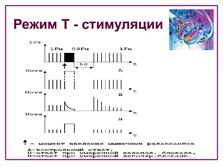 Режим T - стимуляции