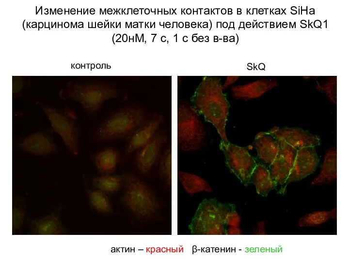 Изменение межклеточных контактов в клетках SiHa (карцинома шейки матки человека)