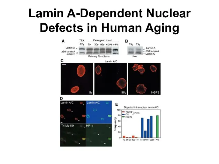 Lamin A-Dependent Nuclear Defects in Human Aging