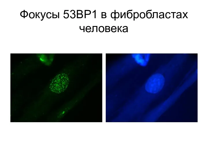 Фокусы 53BP1 в фибробластах человека