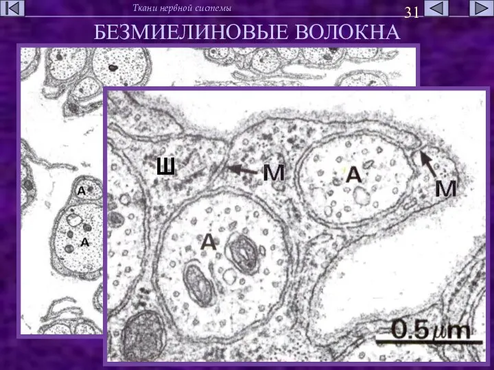 БЕЗМИЕЛИНОВЫЕ ВОЛОКНА