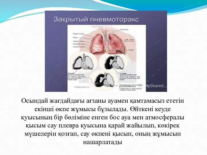 Осындай жағдайдағы ағзаны ауамен қамтамасыз ететін екінші өкпе жұмысы бұзылады.