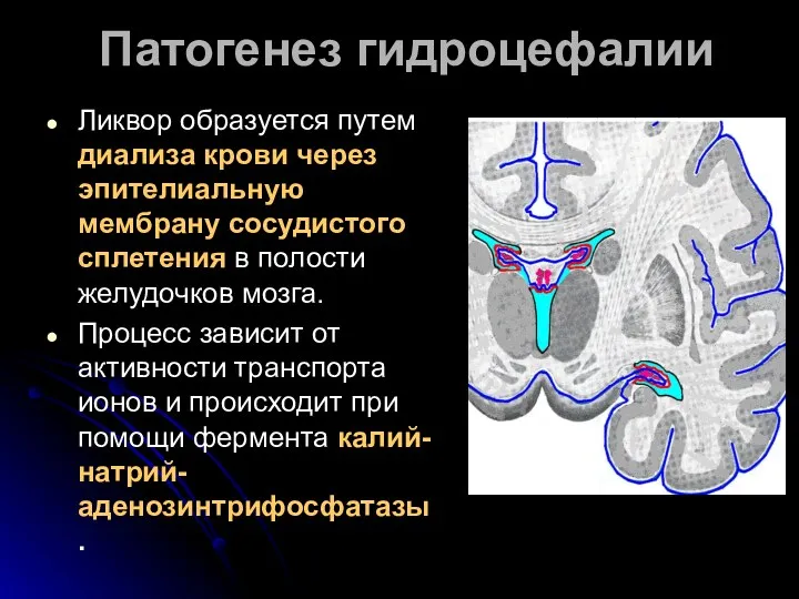 Патогенез гидроцефалии Ликвор образуется путем диализа крови через эпителиальную мембрану