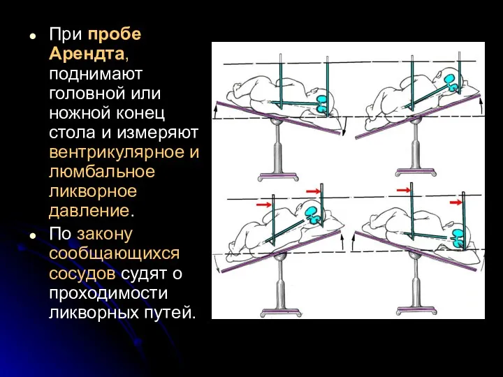 При пробе Арендта, поднимают головной или ножной конец стола и