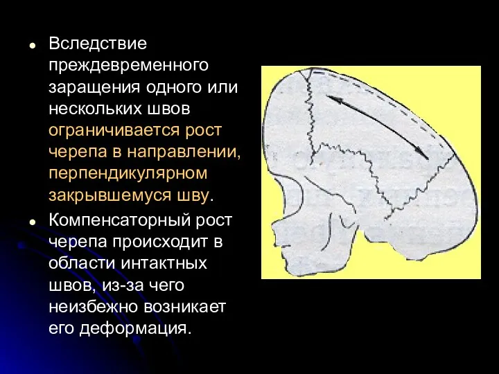 Вследствие преждевременного заращения одного или нескольких швов ограничивается рост черепа