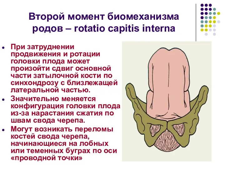 Второй момент биомеханизма родов – rotatio capitis interna При затруднении