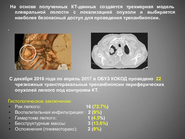 На основе полученных КТ-данных создается трехмерная модель плевральной полости с