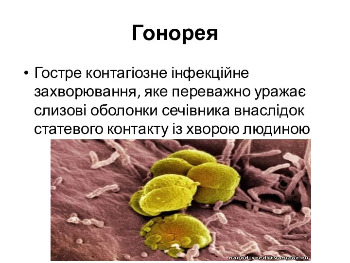 Гонорея Гостре контагіозне інфекційне захворювання, яке переважно уражає слизові оболонки