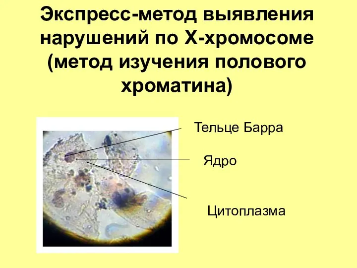 Тельце Барра Ядро Цитоплазма Экспресс-метод выявления нарушений по Х-хромосоме (метод изучения полового хроматина)