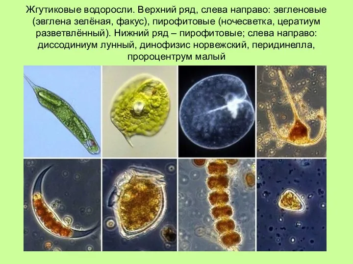 Жгутиковые водоросли. Верхний ряд, слева направо: эвгленовые (эвглена зелёная, факус),