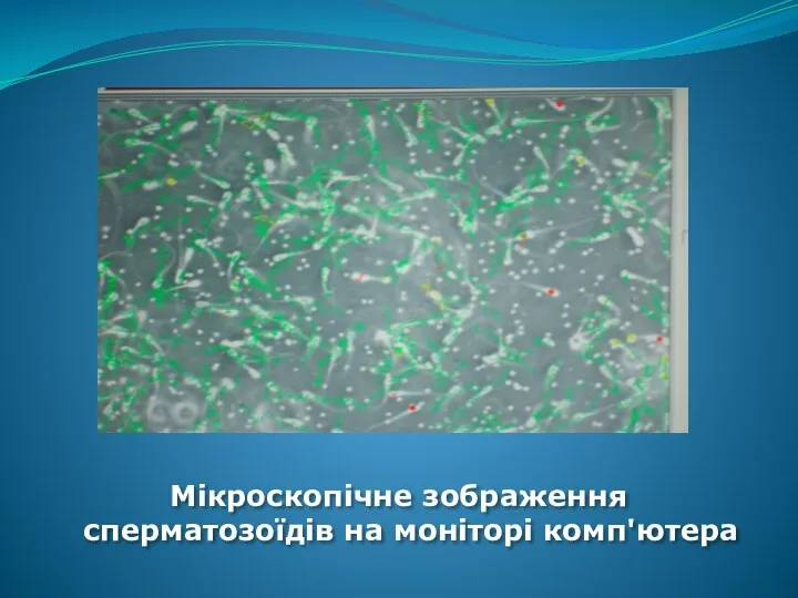 Мікроскопічне зображення сперматозоїдів на моніторі комп'ютера