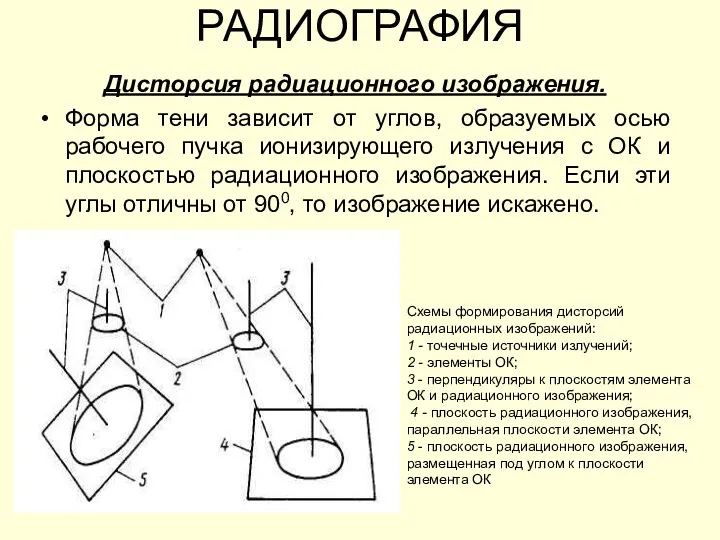 РАДИОГРАФИЯ Дисторсия радиационного изображения. Форма тени зависит от углов, образуемых