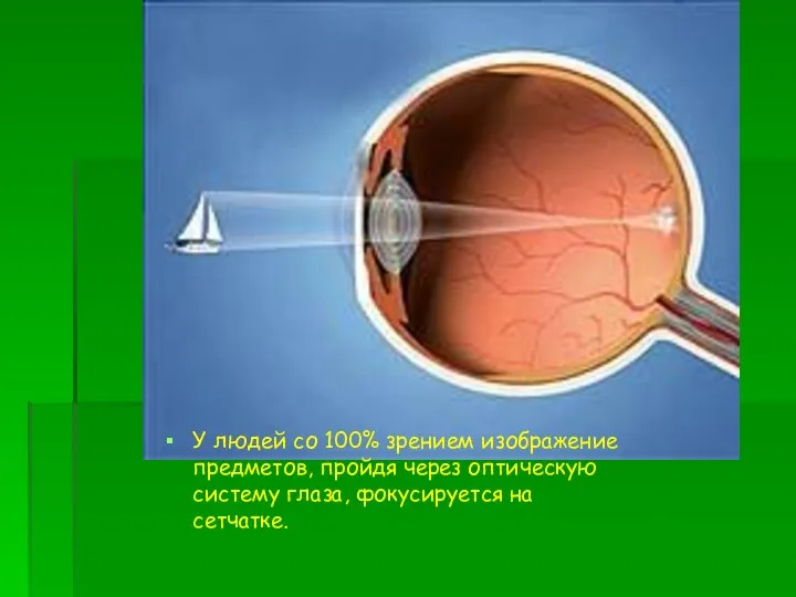 У людей со 100% зрением изображение предметов, пройдя через оптическую систему глаза, фокусируется на сетчатке.