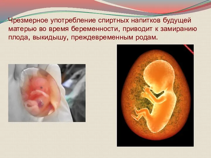 Чрезмерное употребление спиртных напитков будущей матерью во время беременности, приводит к замиранию плода, выкидышу, преждевременным родам.