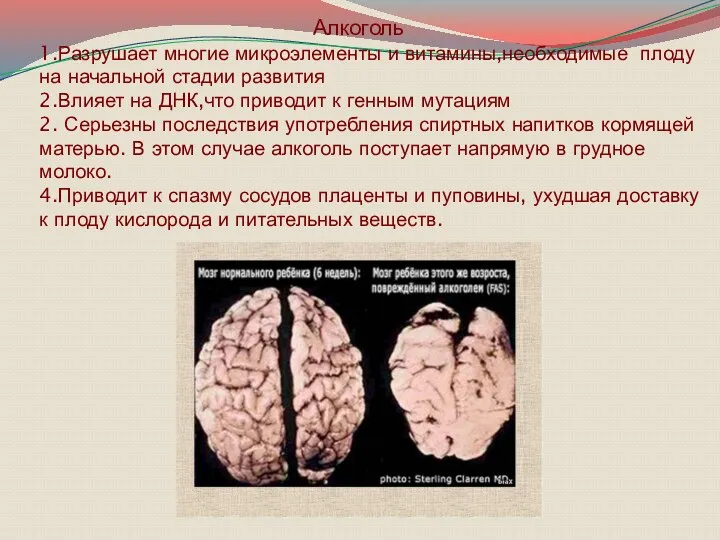 Алкоголь 1.Разрушает многие микроэлементы и витамины,необходимые плоду на начальной стадии