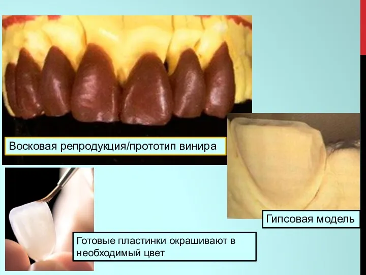 Восковая репродукция/прототип винира Гипсовая модель Готовые пластинки окрашивают в необходимый цвет