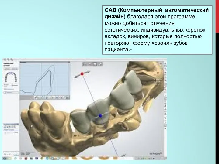 CAD (Компьютерный автоматический дизайн) благодаря этой программе можно добиться получения