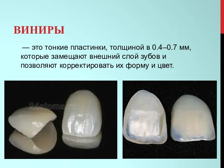 ВИНИРЫ — это тонкие пластинки, толщиной в 0.4–0.7 мм, которые