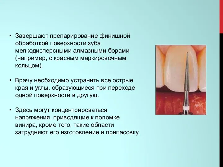 Завершают препарирование финишной обработкой поверхности зуба мелкодисперсными алмазными борами (например,