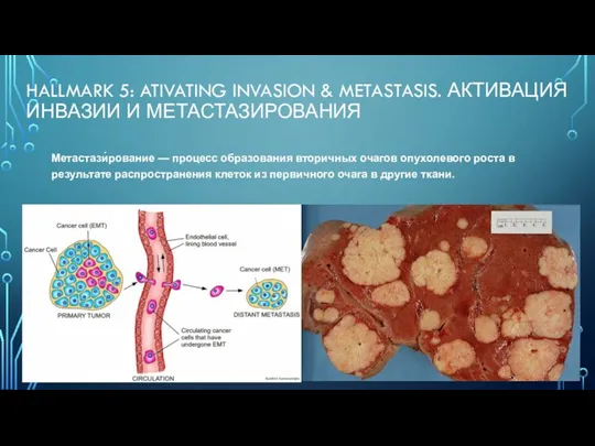 HALLMARK 5: ATIVATING INVASION & METASTASIS. АКТИВАЦИЯ ИНВАЗИИ И МЕТАСТАЗИРОВАНИЯ