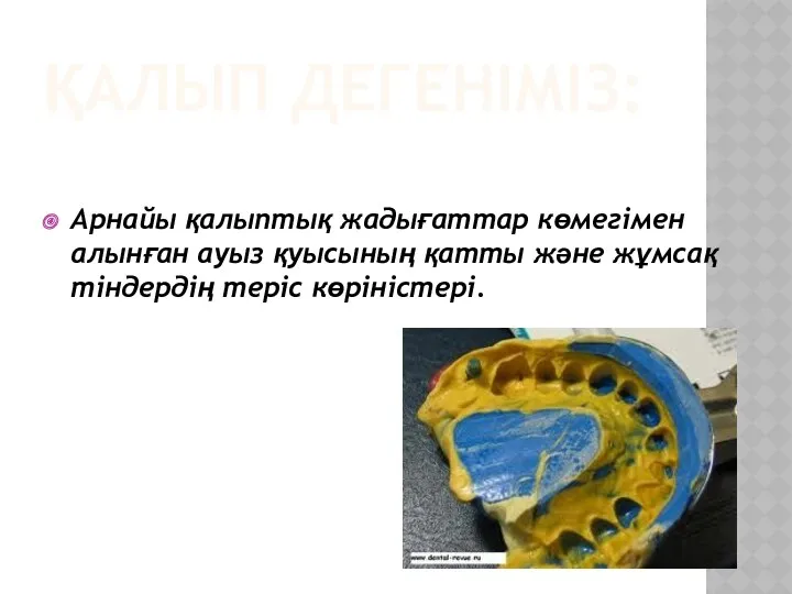 ҚАЛЫП ДЕГЕНІМІЗ: Арнайы қалыптық жадығаттар көмегімен алынған ауыз қуысының қатты және жұмсақ тіндердің теріс көріністері.