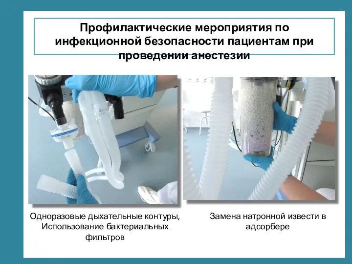 Профилактические мероприятия по инфекционной безопасности пациентам при проведении анестезии Одноразовые