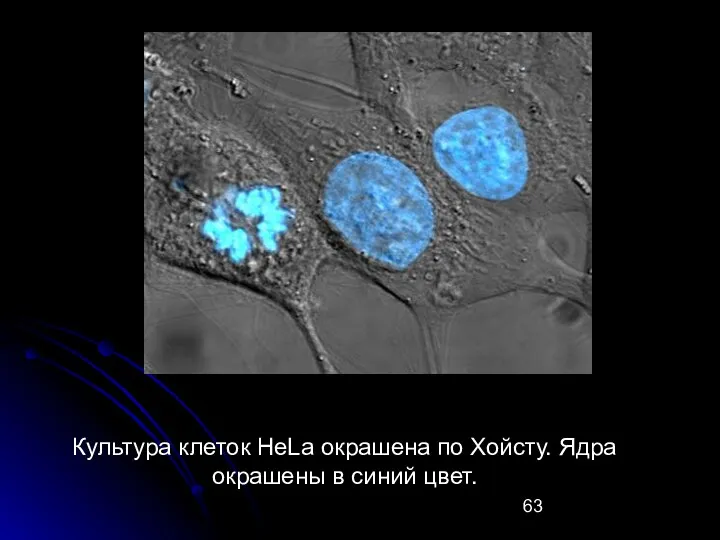 Культура клеток HeLa окрашена по Хойсту. Ядра окрашены в синий цвет.