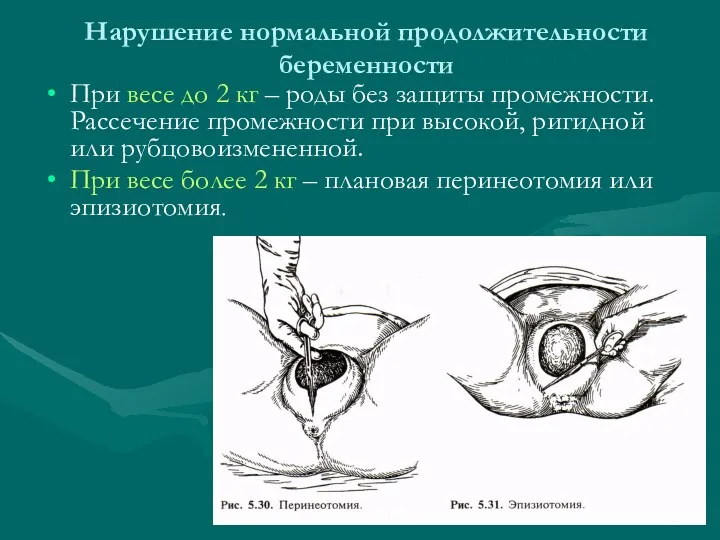 Нарушение нормальной продолжительности беременности При весе до 2 кг – роды без защиты