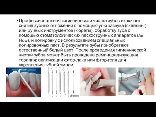 Профессиональная гигиеническая чистка зубов включает снятие зубных отложений с помощью