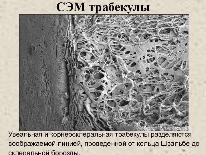 СЭМ трабекулы Увеальная и корнеосклеральная трабекулы разделяются воображаемой линией, проведенной от кольца Швальбе до склеральной борозды.