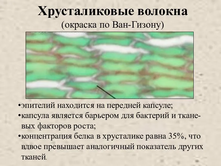 Хрусталиковые волокна (окраска по Ван-Гизону) эпителий находится на передней капсуле;