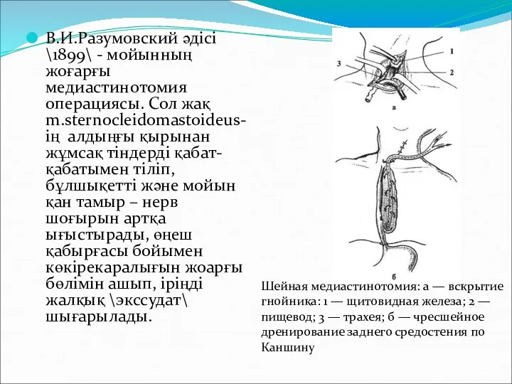 В.И.Разумовский әдісі \1899\ - мойынның жоғарғы медиастинотомия операциясы. Сол жақ