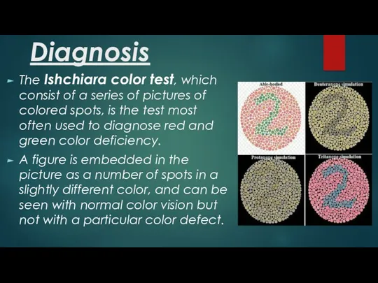 Diagnosis The Ishchiara color test, which consist of a series